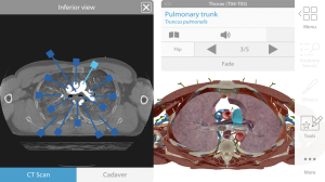 Human Anatomy Atlas 2020: Complete 3D Human Body 3